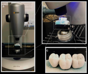 Figure 1. (a) Prosthesis on Sirona InEos Blue scanner base; (b) scanning; (c) silicone-based prosthesiswith the application of Cerec Optispray (Cerec Optispray, Sirona, Bensheim, Germ