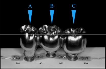 Figure 5. Strain gauges are arranged between the implants and the application load points. Lettersshowing the different loading points.